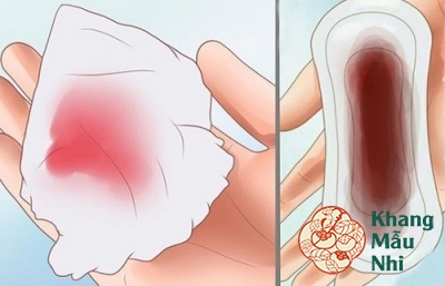 Tổng hợp 10 lý do gây ra máu màu nâu khi mang thai