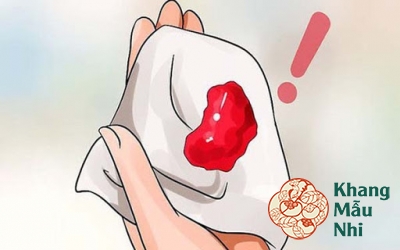 Mẹ bầu bị đau bụng ra máu cục khi mang thai tháng đầu phải làm sao?