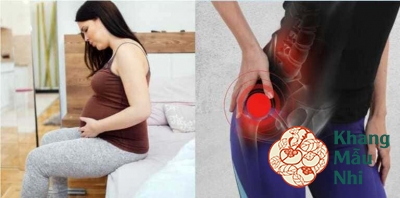Nguyên nhân bà bầu bị đau khớp háng và bí quyết ngăn ngừa