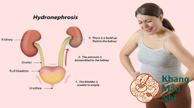Vì sao bạn bị đau lưng và đau bụng dưới khi mang thai?