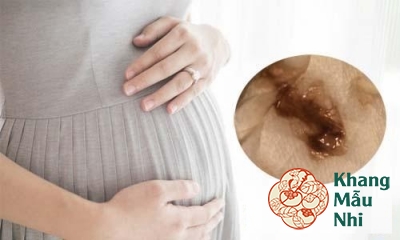 Ra máu màu nâu khi mang thai tuần 5 phải làm sao?