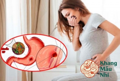 Bí quyết trị đau dạ dày khi mang thai: Hiệu quả từ thiên nhiên