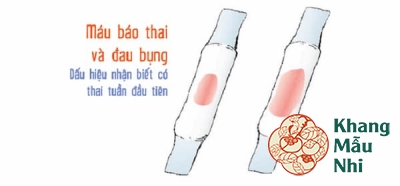 Trả lời 8 thắc mắc thường gặp về máu báo có thai