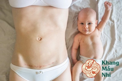 Vì sao mẹ bầu bắt buộc phải sinh mổ mà không thể sinh thường?