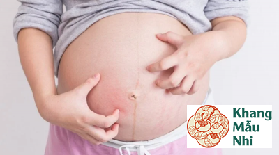 Nguyên nhân nào khiến bà bầu bị mẩn ngứa khi mang thai?