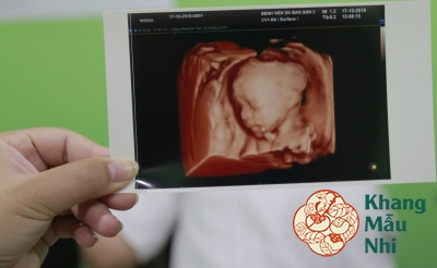 11 điều mẹ bầu nên biết về siêu âm thai trong suốt thai kì