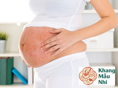 Bị thủy đậu khi mang thai: Chớ coi thường biến chứng nguy hiểm